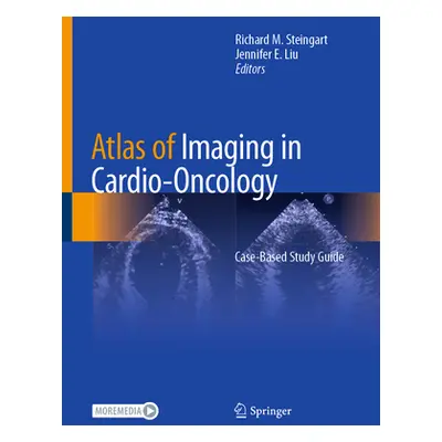 "Atlas of Imaging in Cardio-Oncology: Case-Based Study Guide" - "" ("Steingart Richard M.")(Pevn