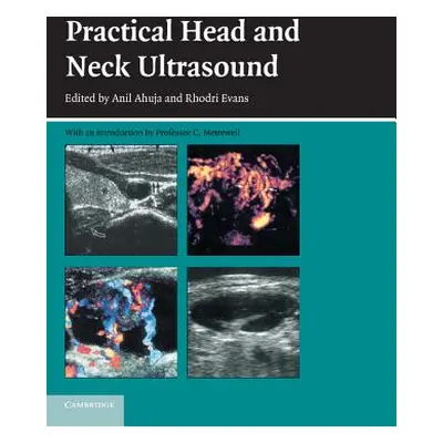 "Practical Head & Neck Ultrasound" - "" ("Ahuja Anil T.")(Paperback)