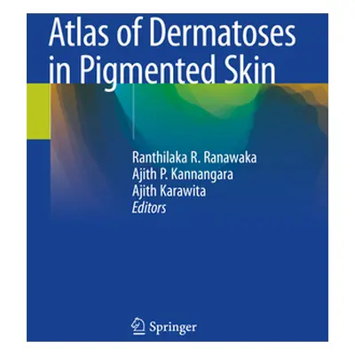 "Atlas of Dermatoses in Pigmented Skin" - "" ("Ranawaka Ranthilaka R.")(Paperback)