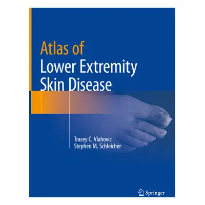 "Atlas of Lower Extremity Skin Disease" - "" ("Vlahovic Tracey C.")(Pevná vazba)