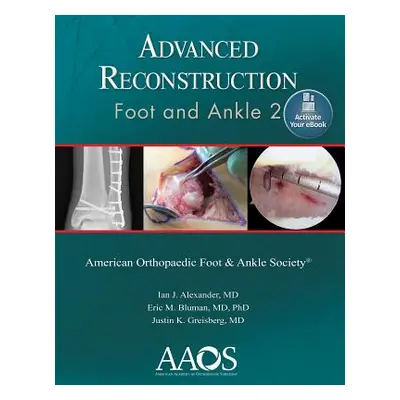 "Advanced Reconstruction: Foot and Ankle 2: Print + eBook" - "" ("Alexander Ian J.")(Paperback)