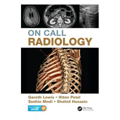 "On Call Radiology" - "" ("Lewis Gareth")(Paperback)