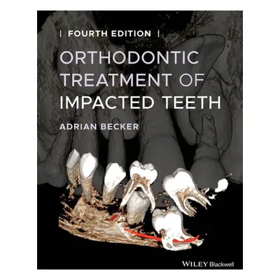 "Orthodontic Treatment of Impacted Teeth" - "" ("Becker Adrian")(Pevná vazba)