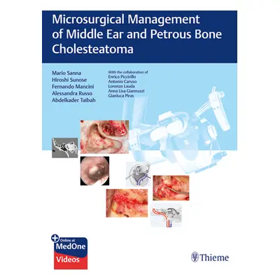 "Microsurgical Management of Middle Ear and Petrous Bone Cholesteatoma" - "" ("Sanna Mario")(Pev