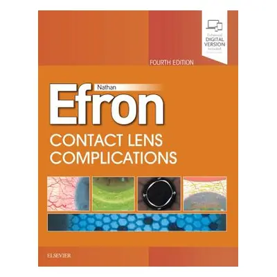 "Contact Lens Complications" - "" ("Efron Nathan")(Pevná vazba)