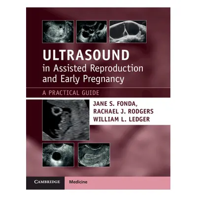 "Ultrasound in Assisted Reproduction and Early Pregnancy: A Practical Guide" - "" ("Fonda Jane S