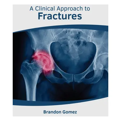 "A Clinical Approach to Fractures" - "" ("Gomez Brandon")(Pevná vazba)