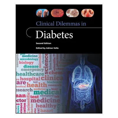 "Clinical Dilemmas in Diabetes" - "" ("Vella Adrian")(Paperback)