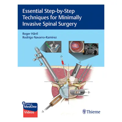 "Essential Step-By-Step Techniques for Minimally Invasive Spinal Surgery" - "" ("Hartl Roger")(P