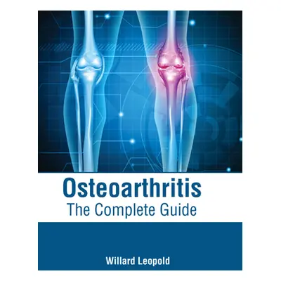 "Osteoarthritis: The Complete Guide" - "" ("Leopold Willard")(Pevná vazba)