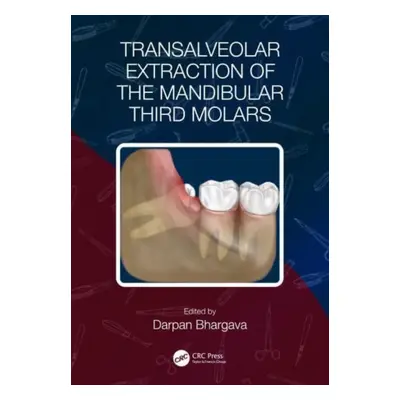 "Transalveolar Extraction of the Mandibular Third Molars" - "" ("Bhargava Darpan")(Paperback)