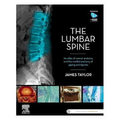 "The Lumbar Spine: An Atlas of Normal Anatomy and the Morbid Anatomy of Ageing and Injury" - "" 