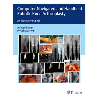 "Computer Navigated and Handheld Robotic Knee Arthroplasty: An Illustrative Guide" - "" ("Jhuran