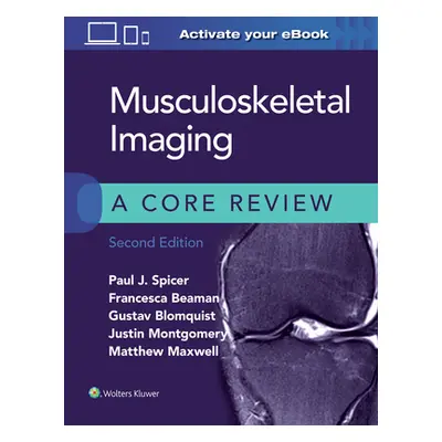 "Musculoskeletal Imaging: A Core Review" - "" ("Spicer Paul")(Paperback)