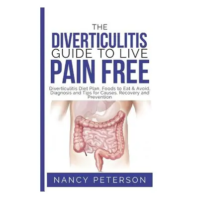 "The Diverticulitis Guide to Live Pain Free: Diverticulitis Diet Plan, Foods to Eat & Avoid, Dia