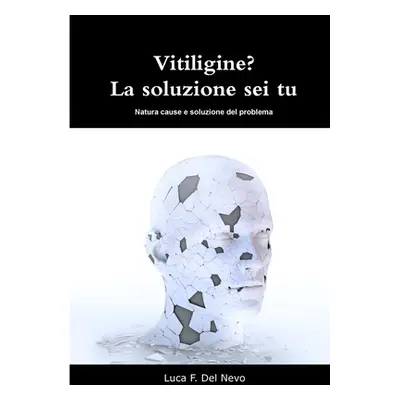 "Vitiligine? La soluzione sei tu" - "" ("Del Nevo Luca F.")(Paperback)