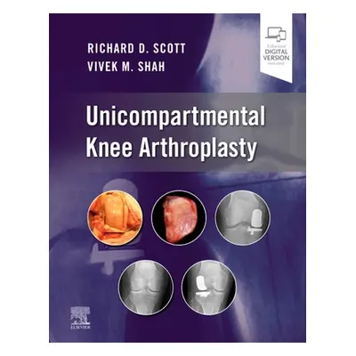 "Unicompartmental Knee Arthroplasty" - "" ("Scott Richard D.")(Pevná vazba)