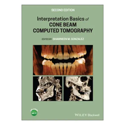 "Interpretation Basics of Cone Beam Computed Tomography" - "" ("Gonzalez Shawneen M.")(Pevná vaz