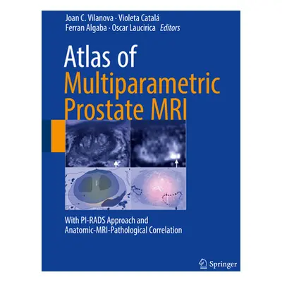 "Atlas of Multiparametric Prostate MRI: With Pi-Rads Approach and Anatomic-Mri-Pathological Corr