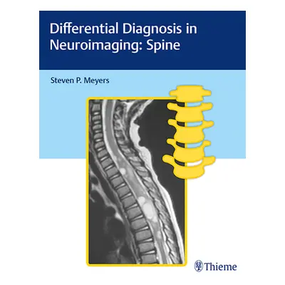 "Differential Diagnosis in Neuroimaging: Spine" - "" ("Meyers Steven")(Pevná vazba)