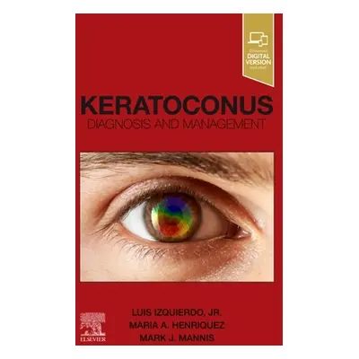 "Keratoconus: Diagnosis and Management" - "" ("Izquierdo Luis")(Paperback)