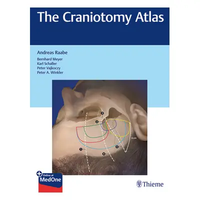 "The Craniotomy Atlas" - "" ("Raabe Andreas")(Pevná vazba)