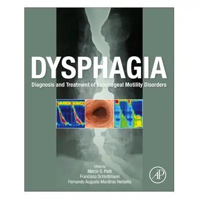 "Dysphagia: Diagnosis and Treatment of Esophageal Motility Disorders" - "" ("Patti Marco")(Paper