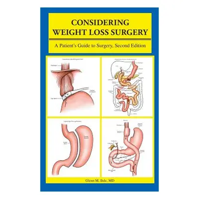 "Considering Weight Loss Surgery: A Patient's Guide to Surgery, Second Edition" - "" ("Ihde MD G