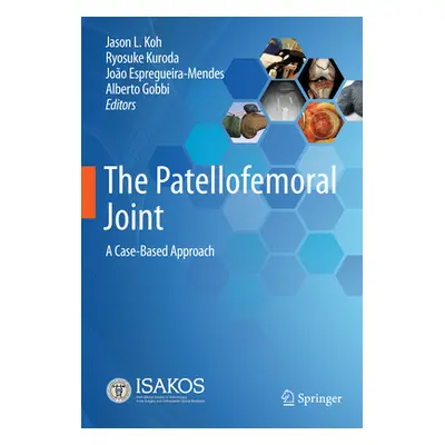 "The Patellofemoral Joint: A Case-Based Approach" - "" ("Koh Jason L.")(Pevná vazba)