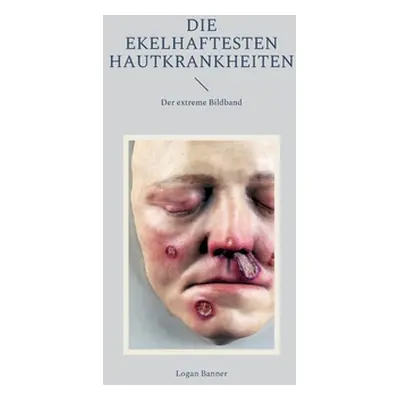 "Die ekelhaftesten Hautkrankheiten: Der extreme Bildband" - "" ("Banner Logan")(Paperback)