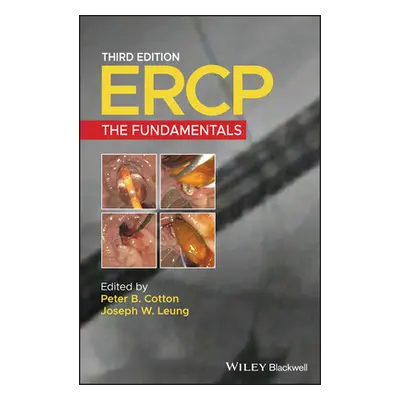 "Ercp: The Fundamentals" - "" ("Cotton Peter B.")(Pevná vazba)