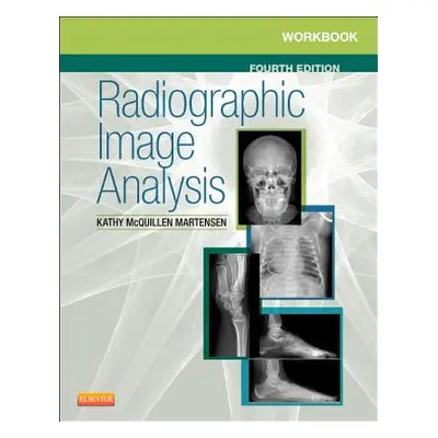 "Workbook for Radiographic Image Analysis" - "" ("McQuillen Martensen Kathy")(Paperback)