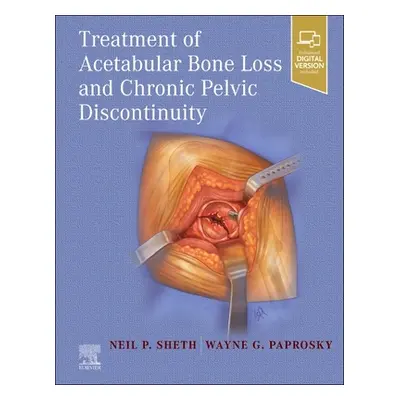 "Treatment of Acetabular Bone Loss and Chronic Pelvic Discontinuity" - "" ("Sheth Neil P.")(Pevn