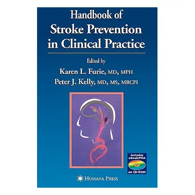 "Handbook of Stroke Prevention in Clinical Practice" - "" ("Furie Karen L.")(Pevná vazba)