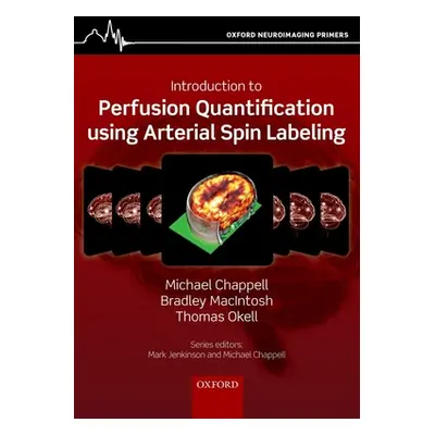 "Introduction to Perfusion Quantification Using Arterial Spin Labelling" - "" ("Chappell Michael