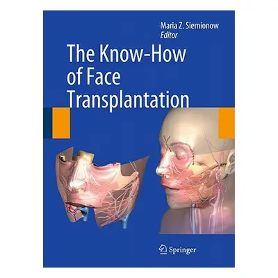 "The Know-How of Face Transplantation" - "" ("Siemionow Maria Z.")(Pevná vazba)