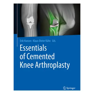 "Essentials of Cemented Knee Arthroplasty" - "" ("Hansen Erik")(Pevná vazba)