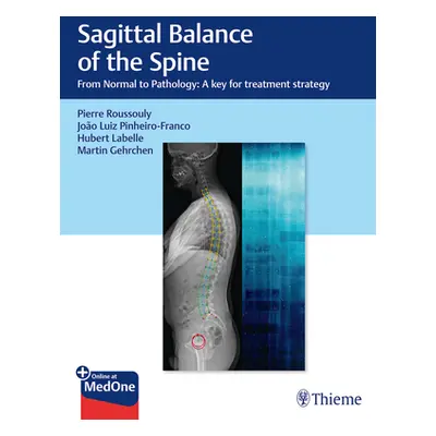 "Sagittal Balance of the Spine: From Normal to Pathology: A Key for Treatment Strategy" - "" ("R