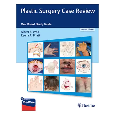 "Plastic Surgery Case Review: Oral Board Study Guide" - "" ("Woo Albert S.")(Paperback)