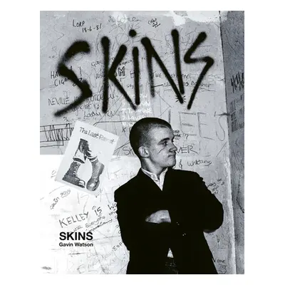 "Skins: Gavin Watson" - "" ("Watson Gavin")(Pevná vazba)