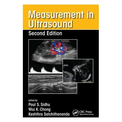 "Measurement in Ultrasound" - "" ("Sidhu Paul S.")(Paperback)