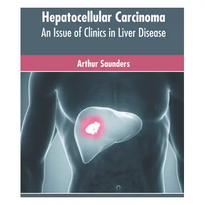 "Hepatocellular Carcinoma: An Issue of Clinics in Liver Disease" - "" ("Saunders Arthur")(Pevná 