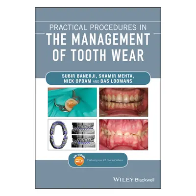 "Practical Procedures in the Management of Tooth Wear" - "" ("Banerji Subir")(Paperback)