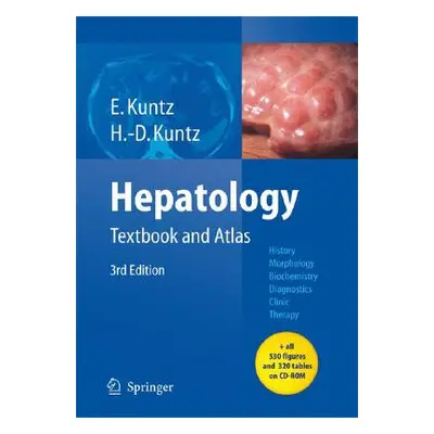 "Hepatology: Textbook and Atlas" - "" ("Kuntz Erwin")(Pevná vazba)