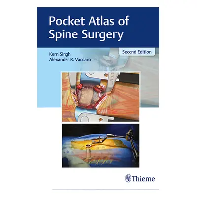 "Pocket Atlas of Spine Surgery" - "" ("Singh Kern")(Paperback)