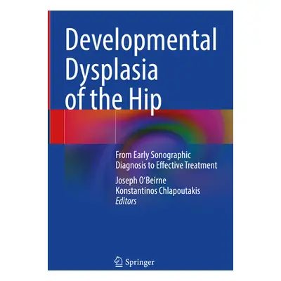 "Developmental Dysplasia of the Hip: From Early Sonographic Diagnosis to Effective Treatment" - 