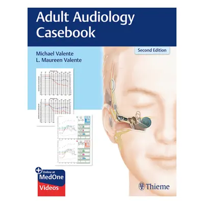 "Adult Audiology Casebook" - "" ("Valente Michael")(Paperback)