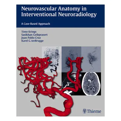 "Neurovascular Anatomy in Interventional Neuroradiology: A Case-Based Approach" - "" ("Krings Ti