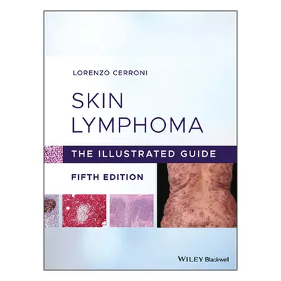 "Skin Lymphoma: The Illustrated Guide" - "" ("Cerroni Lorenzo")(Pevná vazba)