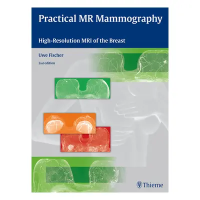 "Practical MR Mammography: High-Resolution MRI of the Breast" - "" ("Fischer Uwe")(Pevná vazba)